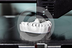 dental prostheses from the 3d printer