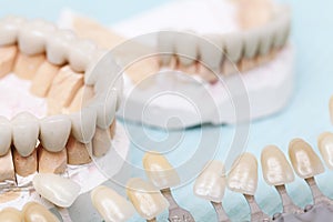 Dental prostheses close up