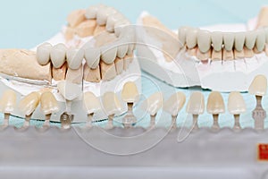 Dental prostheses close up
