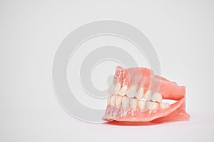 Dental prostheses on a white background. Beautiful teeth ceramic press ceramic crowns and veneers