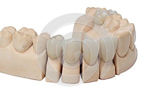 Dental prosthesis