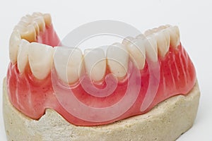 Dental prosthesis