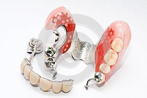 Dental prosthesis