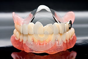 Dental prosthesis