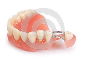 Dental prosthesis img