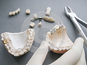 Dental prosthesis jaws dentures crowns forceps