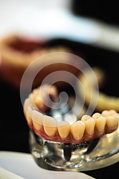 Dental prosthesis with metal