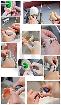 Dental prosthesis preparation process