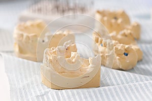 Dental prosthesis work