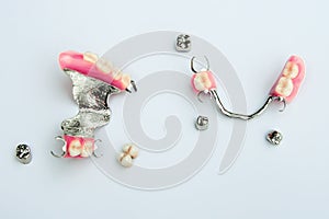 Dental prosthetics concept. tooth replacement. dentistry. removable clasp prostheses with metal and ceramic-metal crowns.