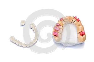 dental prosthetics. tooth restoration. ceramic white teeth. bridge prosthesis. Isolated on a white background