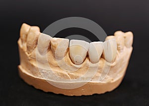 Dental Prothetic laboratory photo