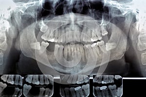 Dental radiography Digital x-ray teeth scan of adult male