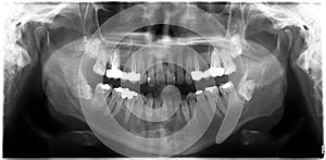 Dental x-ray