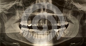 Dental x-ray