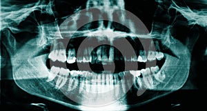 Dental x-ray