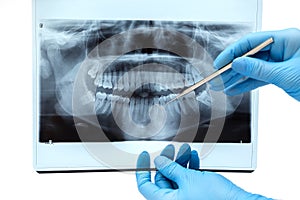 Dental X-ray