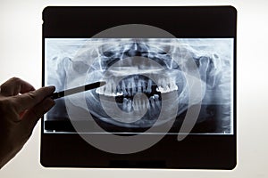 Dental x ray film for dental care concept