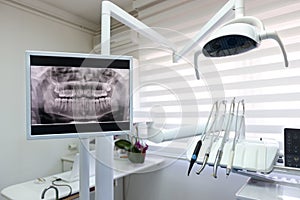 Dental x-ray footage in dental clinic