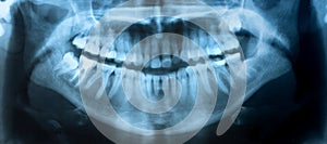 Dental X-Ray panoramic