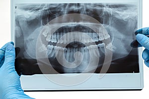 Dental X-ray. Radiography