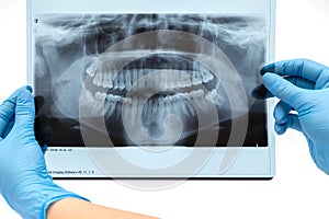 Dental X-ray. Radiography