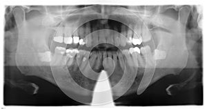 Dental roentgenography