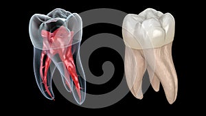 Dental root anatomy - First maxillary molar tooth. Medically accurate dental 3D animation