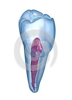 Dental root anatomy - Mandibular Second premolar tooth. Medically accurate dental illustration photo
