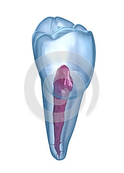 Dental root anatomy - Mandibular Second premolar tooth. Medically accurate dental illustration