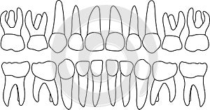 dental row primary teeth