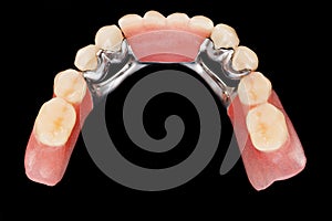 Dental skeletal prosthesis - upper vew