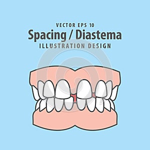 Dental spacing or diastema teeth illustration vector design on blue background. Dental care concept