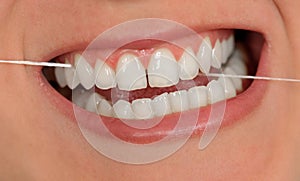 Dental string