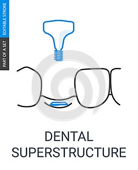 Dental superstructure installation photo