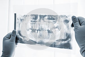 Dental surgery preparation x-ray scan close-up