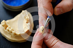 The dental technician is engaged in a modeling of artificial dentures. The hands of a dental technician close-up