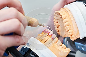 Dental technician or prosthesis work. prosthetic dentistry process photo