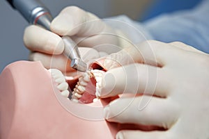 Dental technician grinding workpiece on jaw implant working in dental laboratory, dentistry