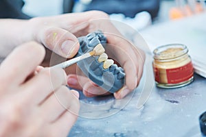 Dental technician work. prosthesis production. teeth prototype construction photo