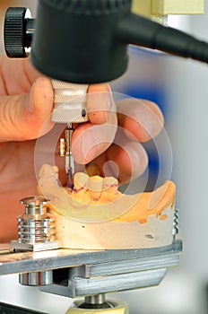 Dental technician measuring dentures