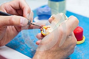 Zahnmedizinisch techniker modellieren wachs brücke 