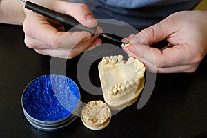 Dental technician modelling tooth crowns with hot wax