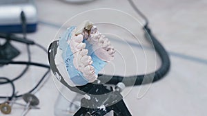 A dental technician places a dental crown on a jaw model.