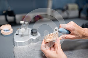 Dental technician preparing prosthesis for the patient.