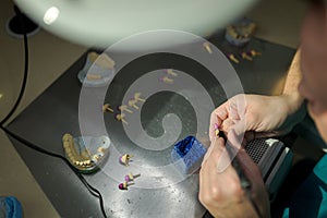 Dental technician preparing teeth for ceramic castingdental technician preparing teeth for ceramic casting