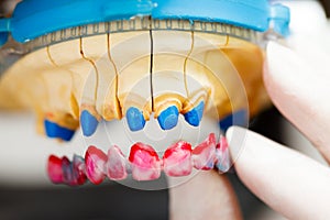 Dental Technician's Work