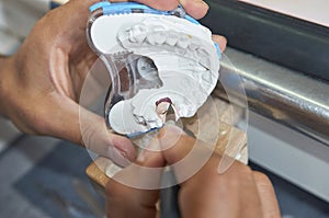 Dental technician using a brush with ceramic dental implants in