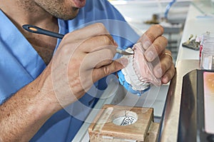 Dental technician using a brush with ceramic dental implants in