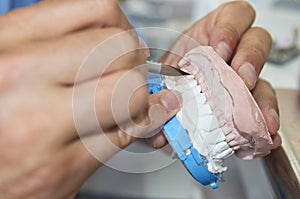 Dental technician using a brush with ceramic dental implants in